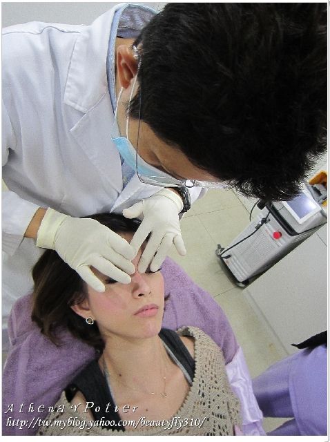 微晶瓷隆鼻過程06
