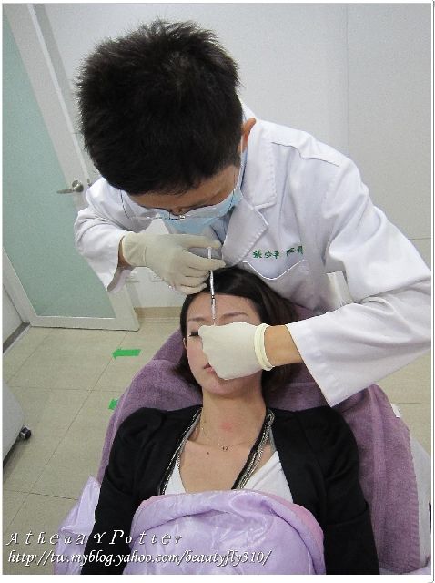 微晶瓷隆鼻過程03