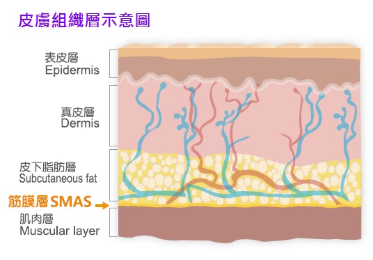 音波拉提可作用的皮膚組織-SMAS